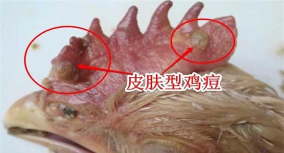 鸡痘的最好治疗方法