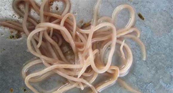 蛔虫病症状